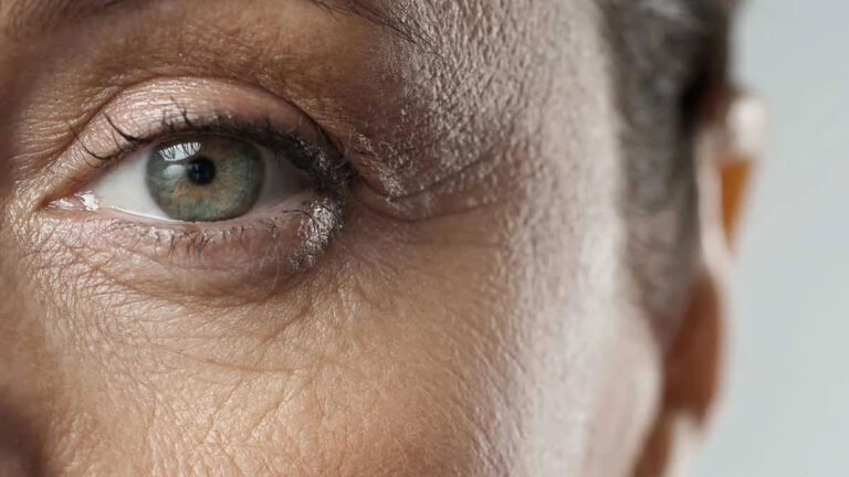 chronic stress skin aging, cortisol sleep disruption